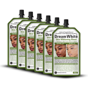 Dream White Skin Whitening Blend 50gm (Pack of 06)